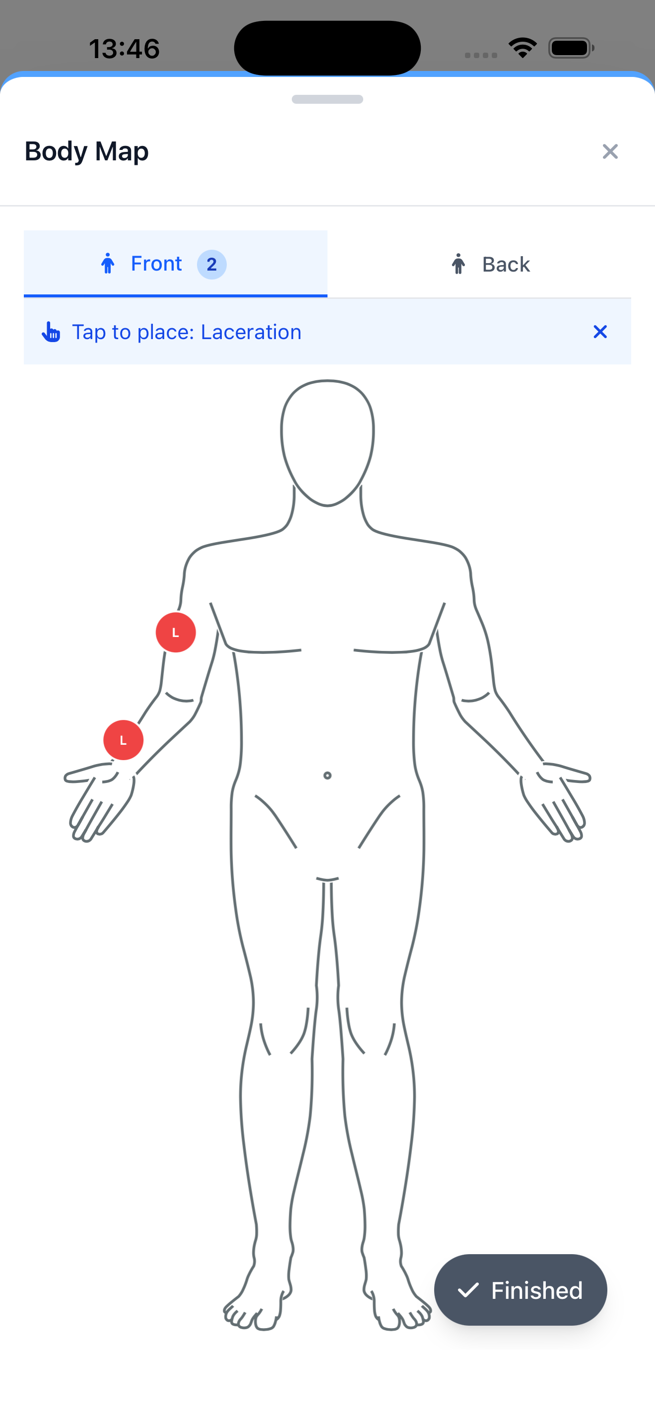 Interactive Body Map